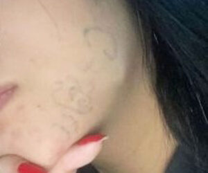Teen Whose Face Was Tattooed By Sick Ex Tells Of Recovery