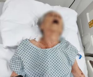  Woman Declared Dead Found Alive In Hospital Morgue