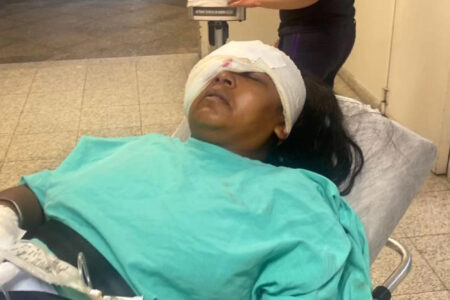 Read more about the article Woman’s Face Rebuilt But Cannot See After She Is Hit By Bullet Fired By Cop