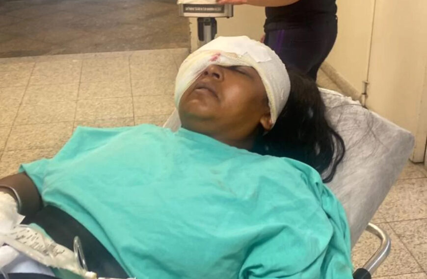 Woman’s Face Rebuilt But Cannot See After She Is Hit By Bullet Fired By Cop
